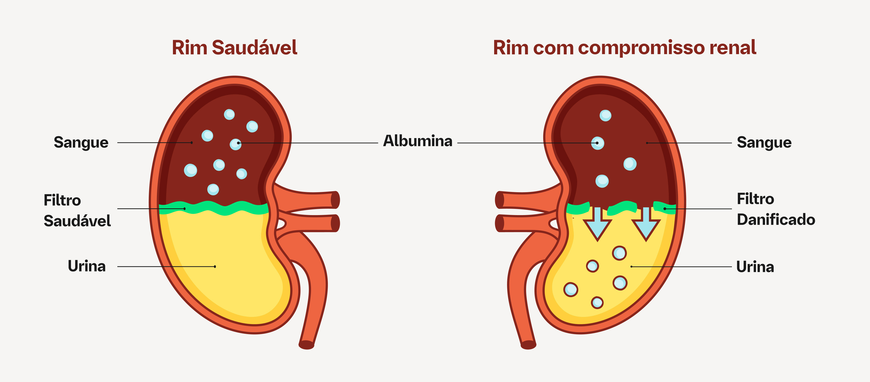 Rim Saudável Rim com compromisso renal